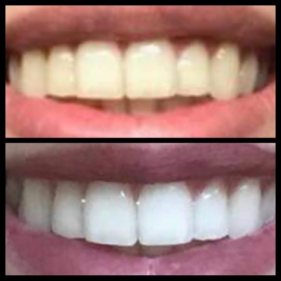 Toothpaste - Picture 3 of 6